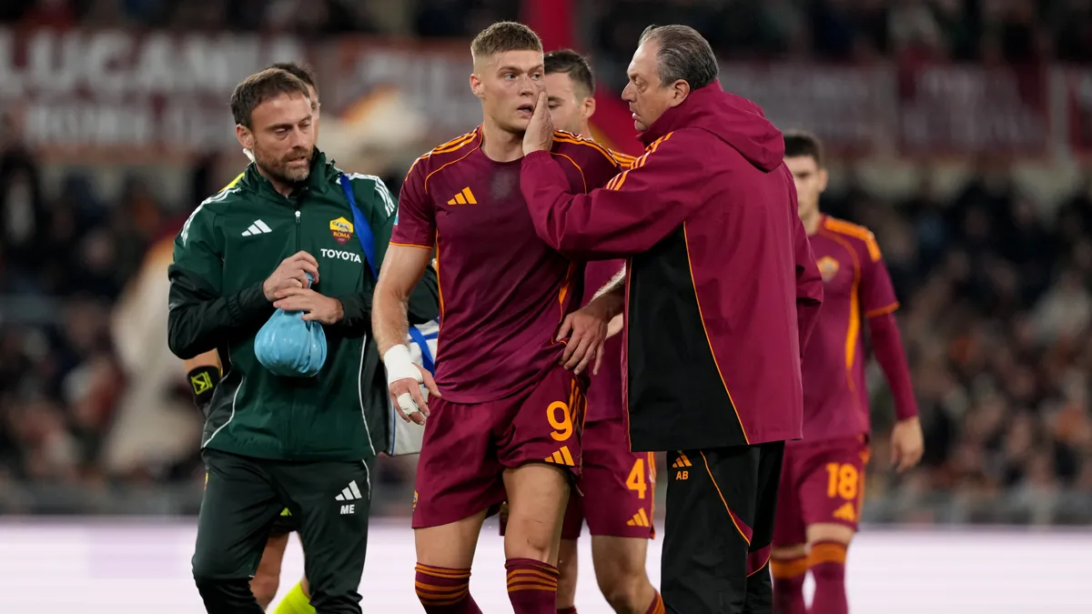 Довбик продовжує відновлюватися після травми: чи зіграє форвард Роми у наступному турі Серії А проти Ювентуса