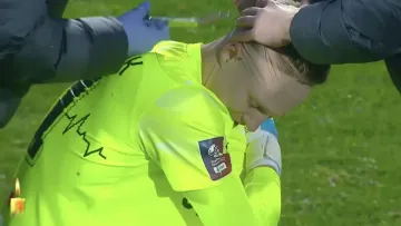 «Укус комара‎» чи важка травма: тренер Колоса відреагував на розбиту голову свого воротаря у матчі з Динамо